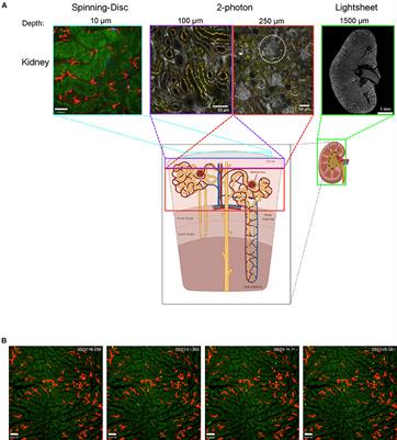 Intravital Imaging Allows Organ-Specific Insights Into Immune Functions